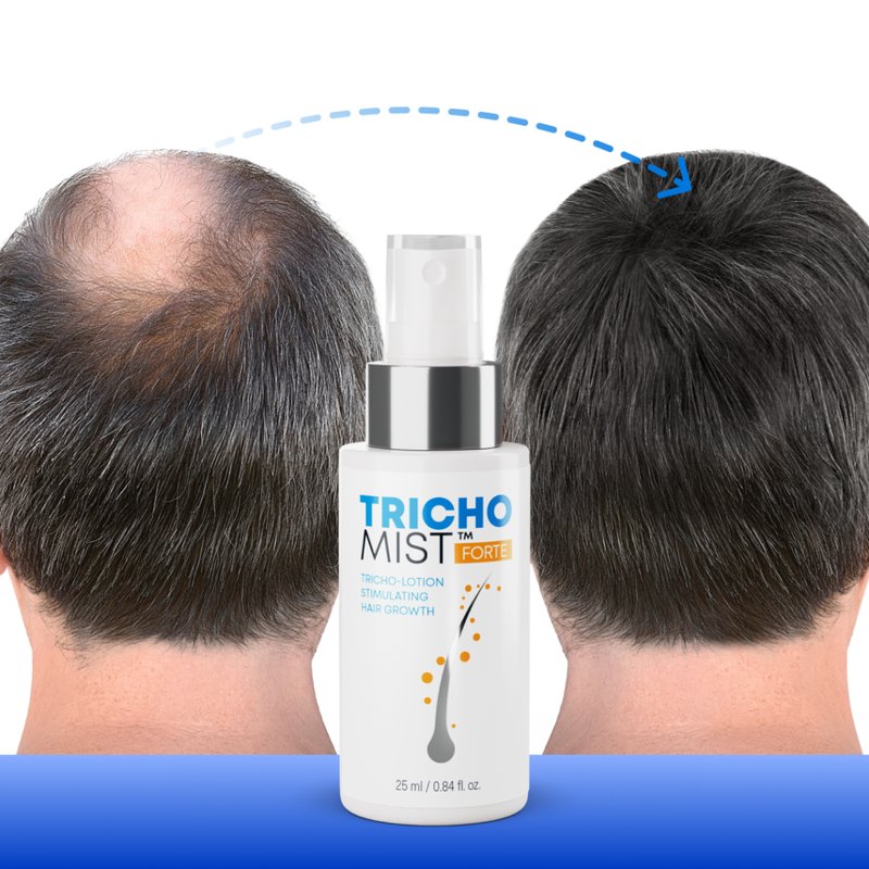 A look at trichomist forte wzmocnienie cebulek